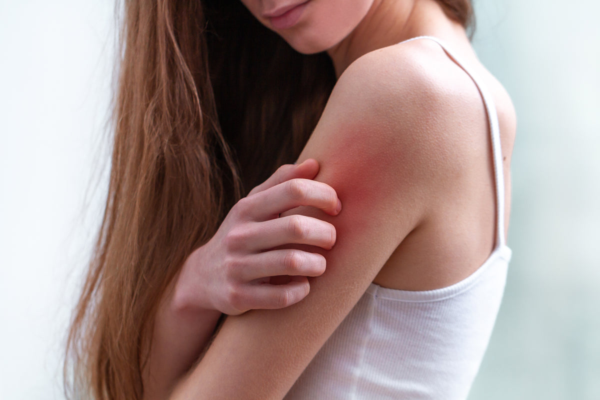 Dermatita (eczema) cauze, simptome, preventie si tratament