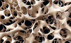 Vitamina K scade riscul de osteoporoza