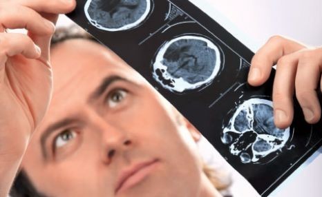 Cand ai risc sporit de Parkinson?
